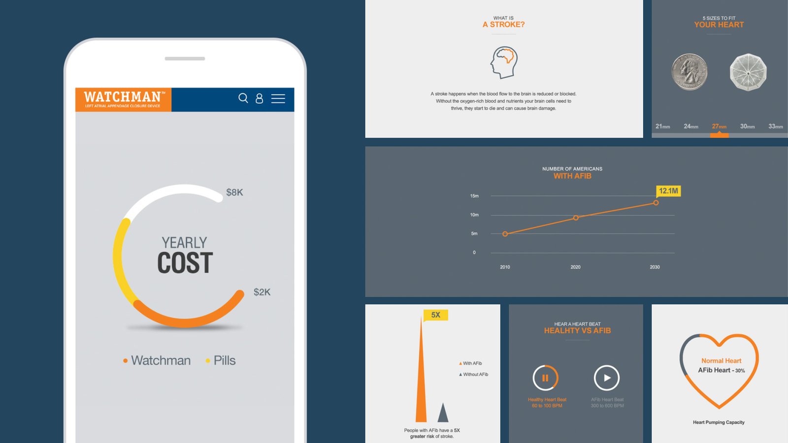 Boston Scientific